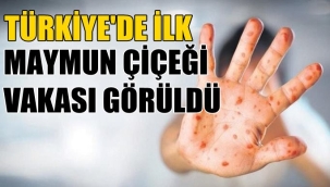 MAYMUN ÇİÇEĞİ TÜRKİYE'DE 